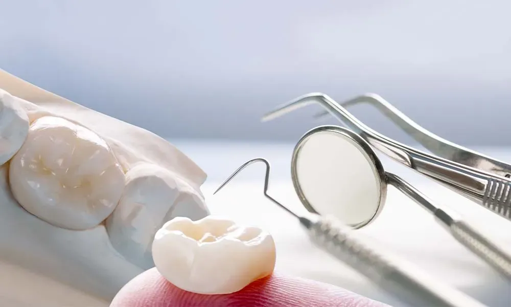 Dental Crowns: Unlocking a World of Benefits for a Healthier, Happier Smile