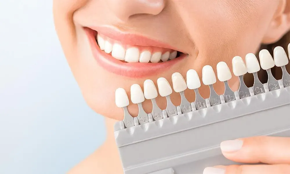 Reinvent Your Smile With Dental Veneers