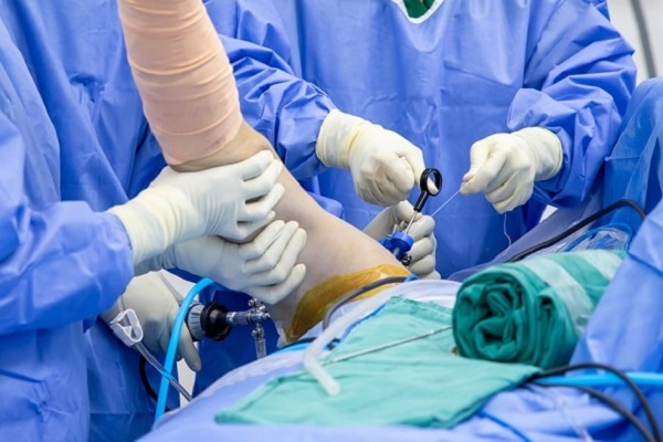 Arthroscopy