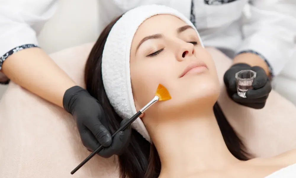 Dermatologists’ Take On Chemical Peels: Benefits And Risks