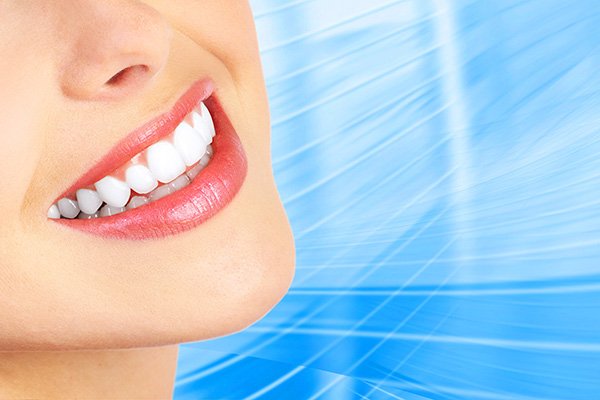 At-Home Teeth Whitenings